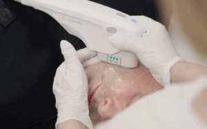 Discover Ultherapy® Prime for men at Aesthetic Health Leeds. A regenerative, non-surgical skin tightening treatment for a stronger jawline, firmer skin, and long-lasting natural results.